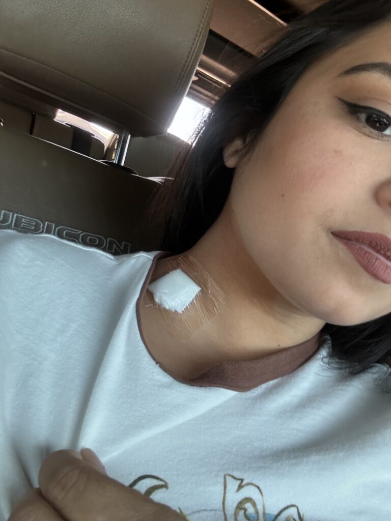 Young woman shows neck lesion due to cancer she suffers